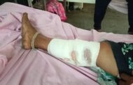डुकराने हल्ला करून एक महिला जखमी तर दुसरा पुरुष  आजनसरा शेतात गंभीर जखमी