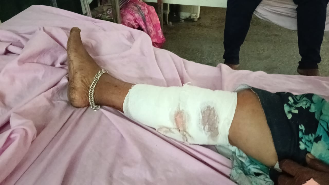 डुकराने हल्ला करून एक महिला जखमी तर दुसरा पुरुष  आजनसरा शेतात गंभीर जखमी
